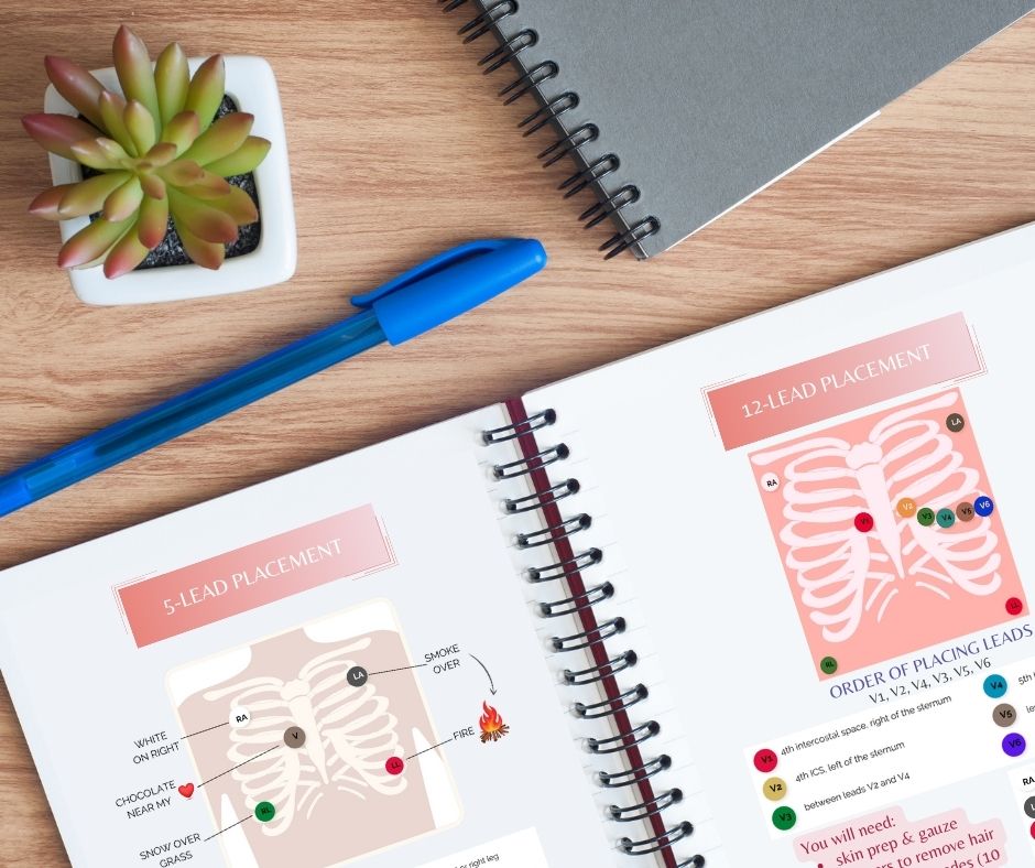 The Basics: EKG Interpretation Resource Guide