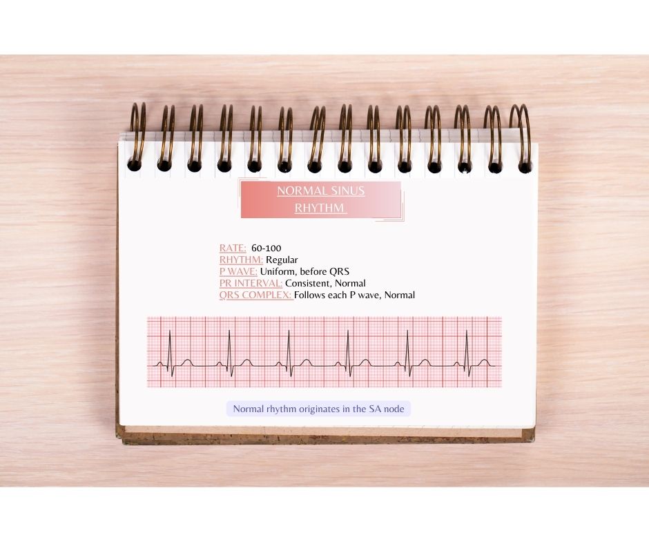 The Basics: EKG Interpretation Resource Guide